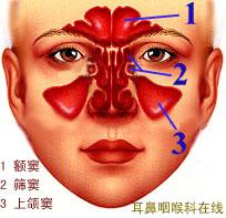 上颌窦,筛窦,额窦的位置如图所示