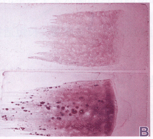 骨髓小粒显微镜图片图片